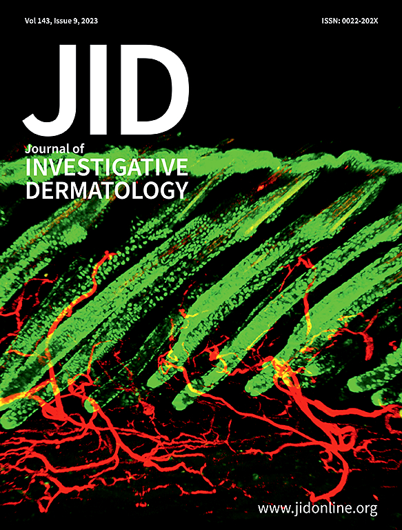 JOURNAL OF INVESTIGATIVE DERMATOLOGY