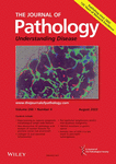 JOURNAL OF PATHOLOGY