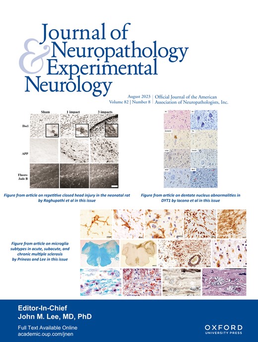 JNCI-JOURNAL OF THE NATIONAL CANCER INSTITUTE