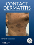 CONTACT DERMATITIS
