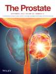 PROSTATE