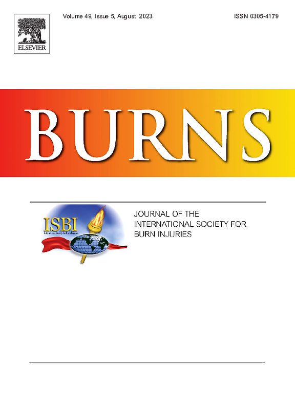 BURNS
