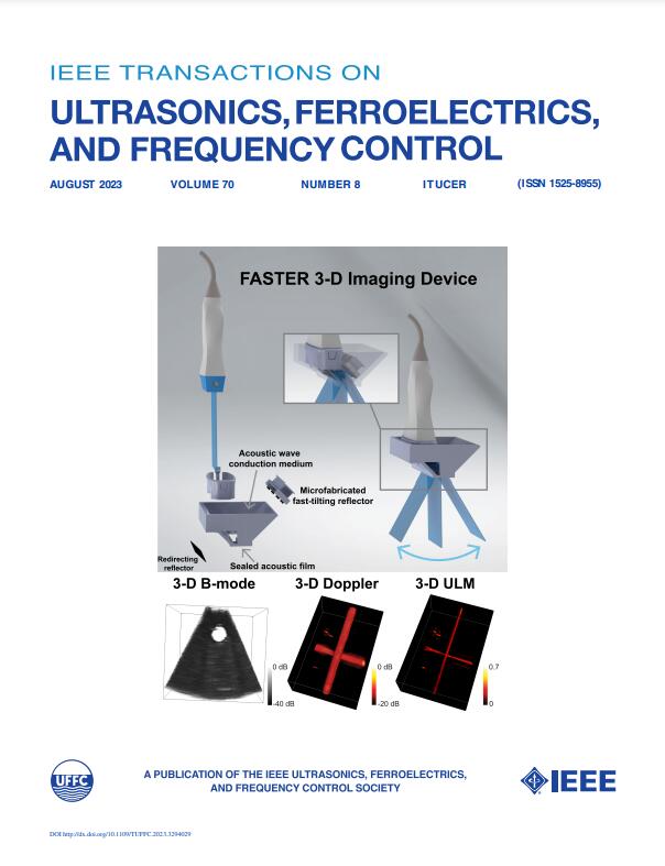 IEEE TRANSACTIONS ON ULTRASONICS FERROELECTRICS AND FREQUENCY CONTROL
