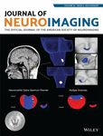 JOURNAL OF NEUROIMAGING