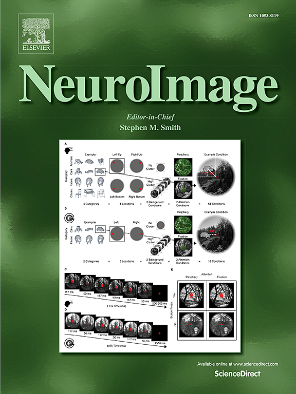 NEUROIMAGE