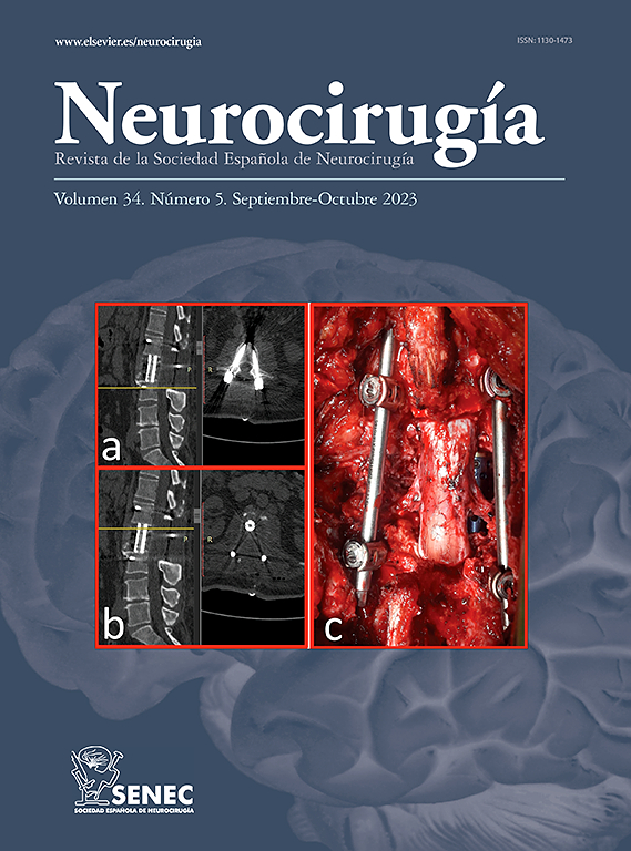 NEUROCIRUGIA