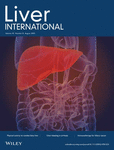 LIVER INTERNATIONAL
