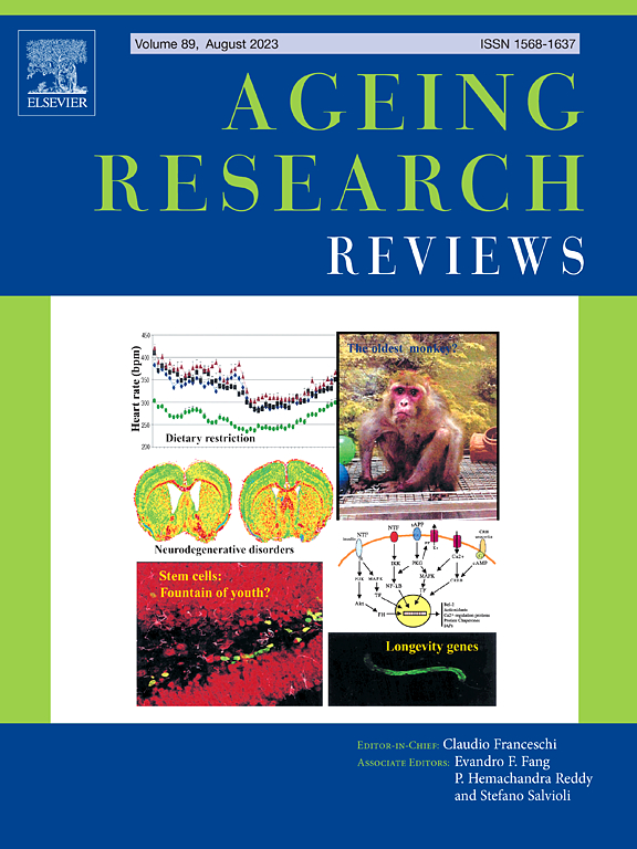AGEING RESEARCH REVIEWS