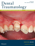 DENTAL TRAUMATOLOGY