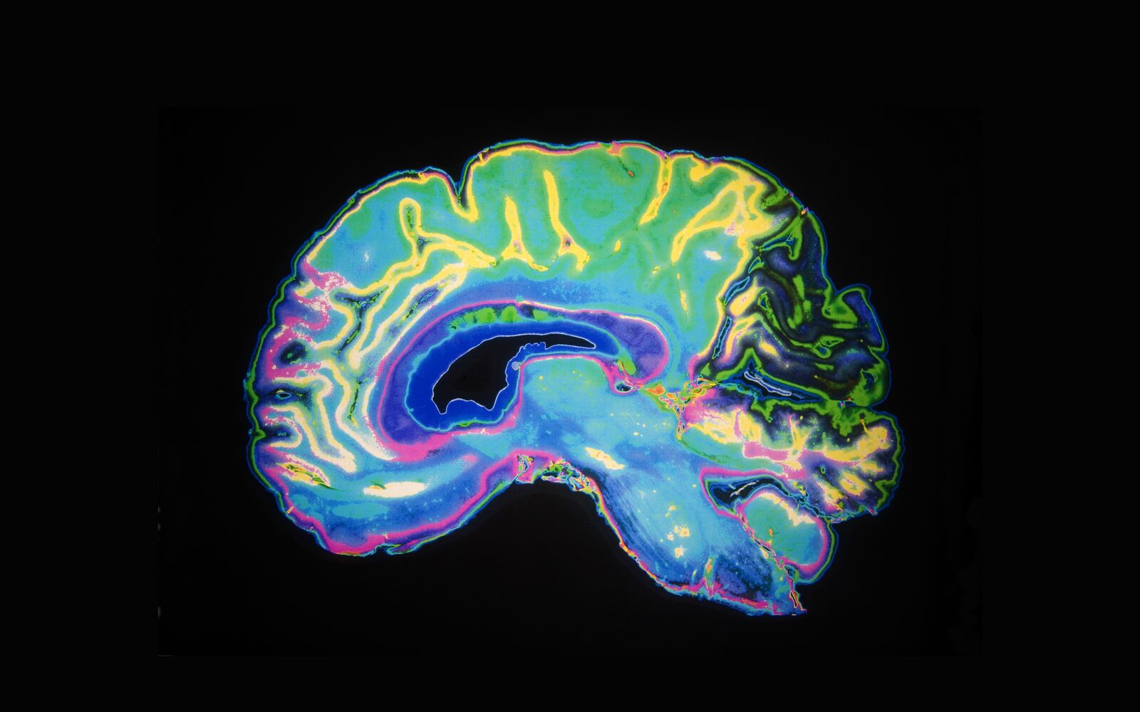 FRONTIERS IN BEHAVIORAL NEUROSCIENCE