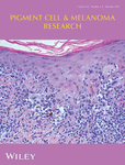 PIGMENT CELL & MELANOMA RESEARCH