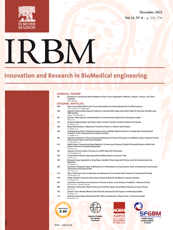 IRBM