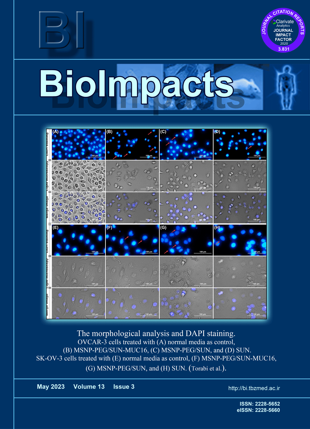 BIOIMPACTS