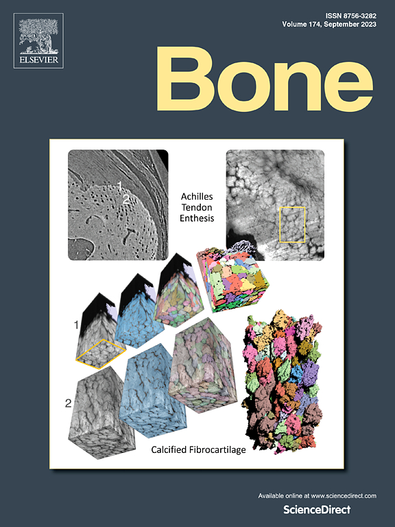 BONE